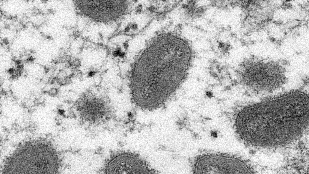 The WHO says genome sequencing of monkeypox cases will help inform understanding of the outbreak.