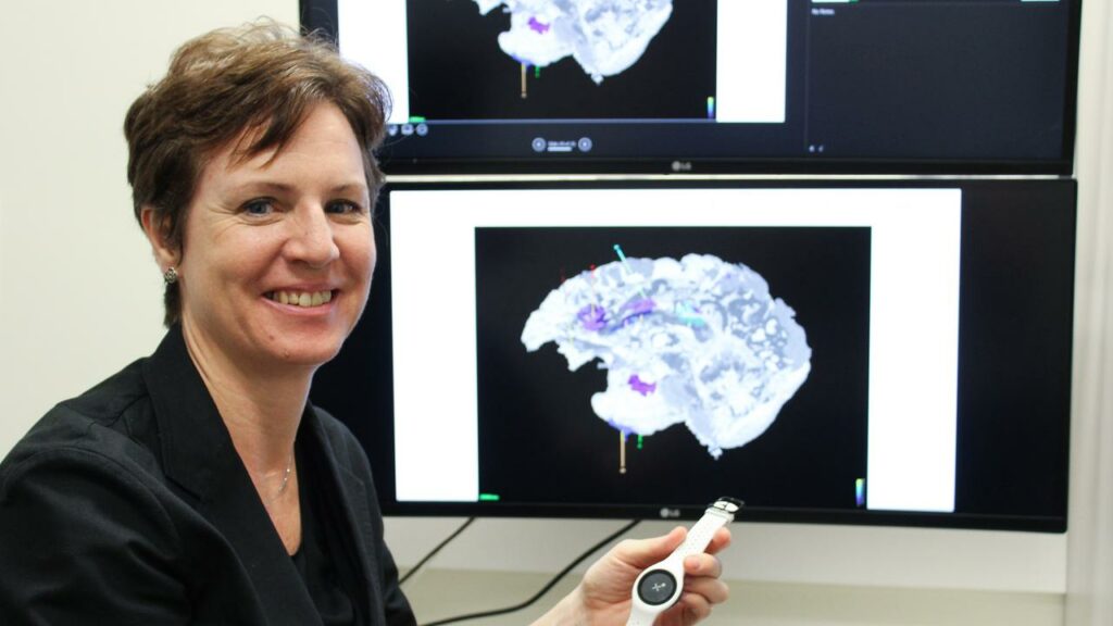 Aileen McGonigal says the study will examine how smartwatches might serve people with epilepsy.