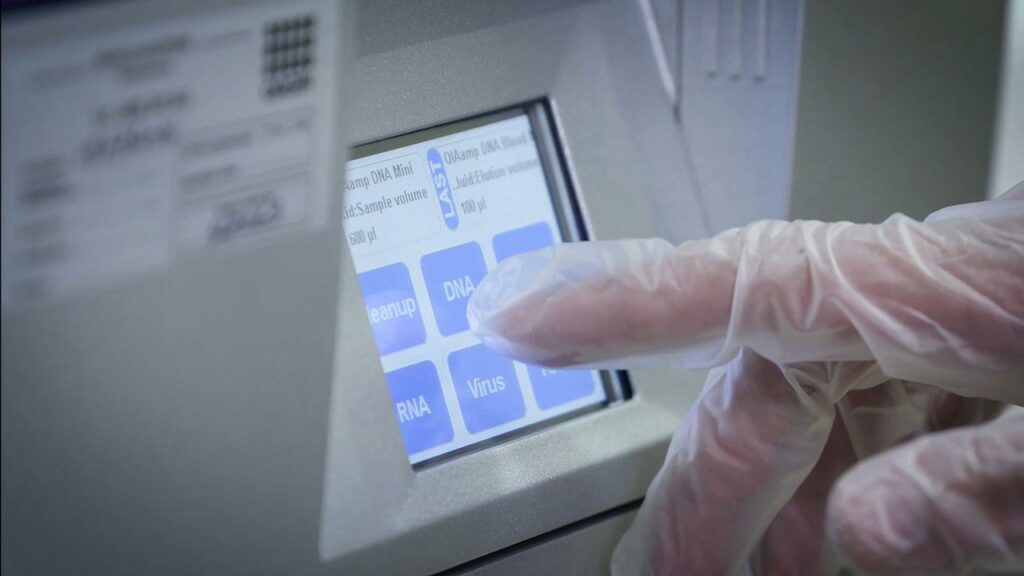 A young man on a murder charge has been granted bail due to Queensland’s delays in DNA testing.