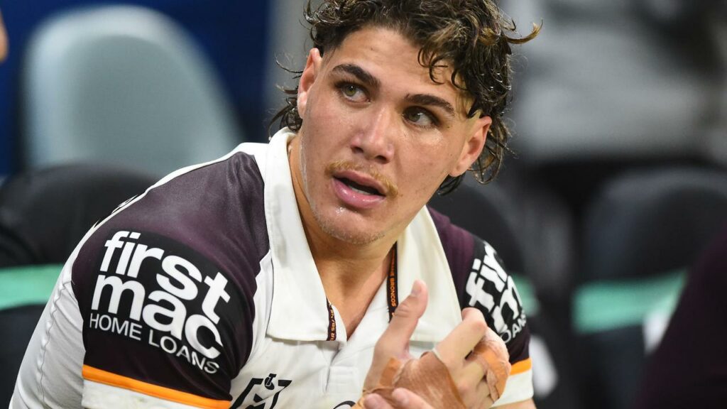 Broncos star Reece Walsh nurses his hand injury, now confirmed as a bone facture.