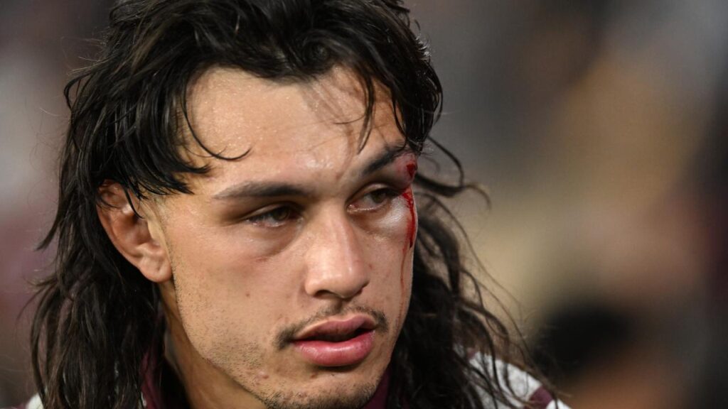 Tino Fa’asuamaleaui is keen to back up after Origin for the Titans, but in doubt with an eye wound.