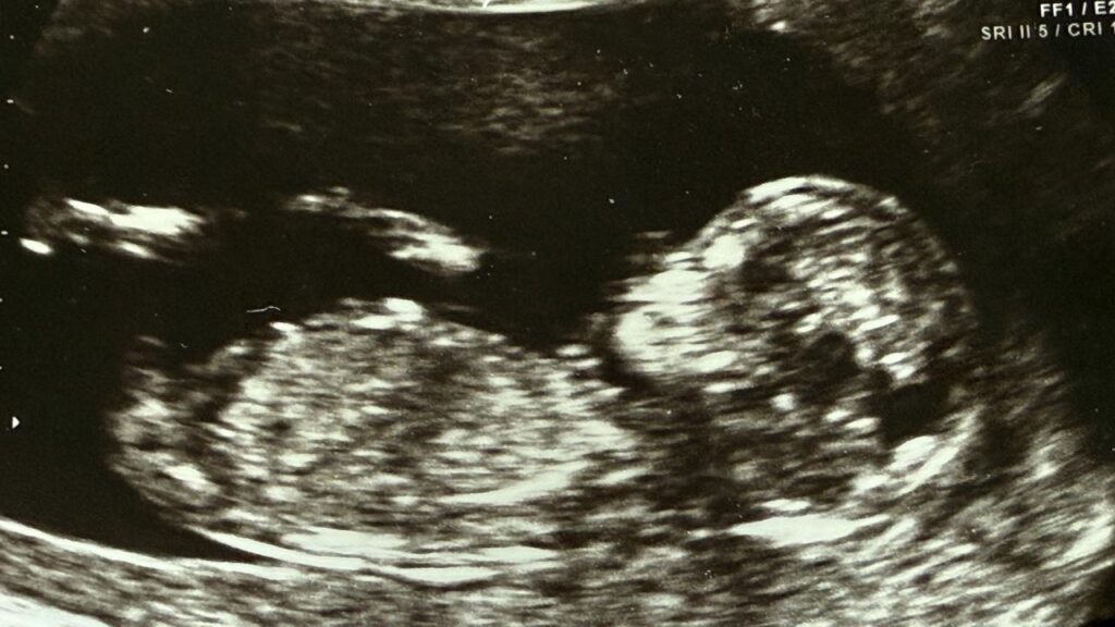 A major private fertility company is at the centre of another IVF bungle.