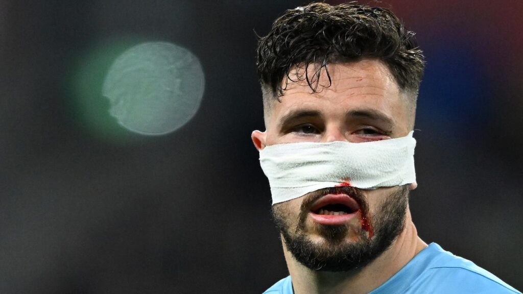 Mathew Leckie played through the pain barrier to help Melbourne City win the A-League final.

