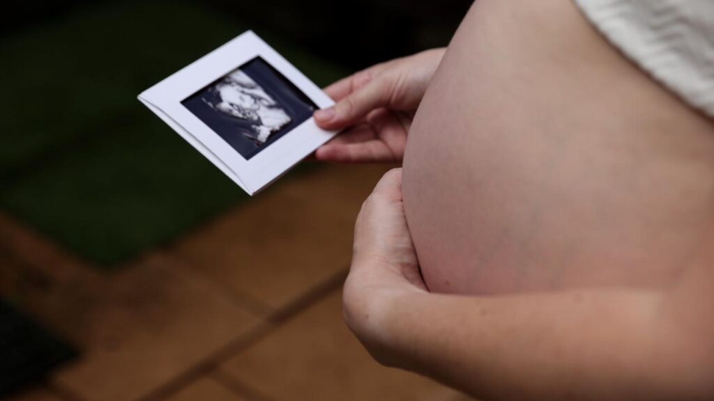 A report is urging government investment in rural maternity services before, during and after birth.