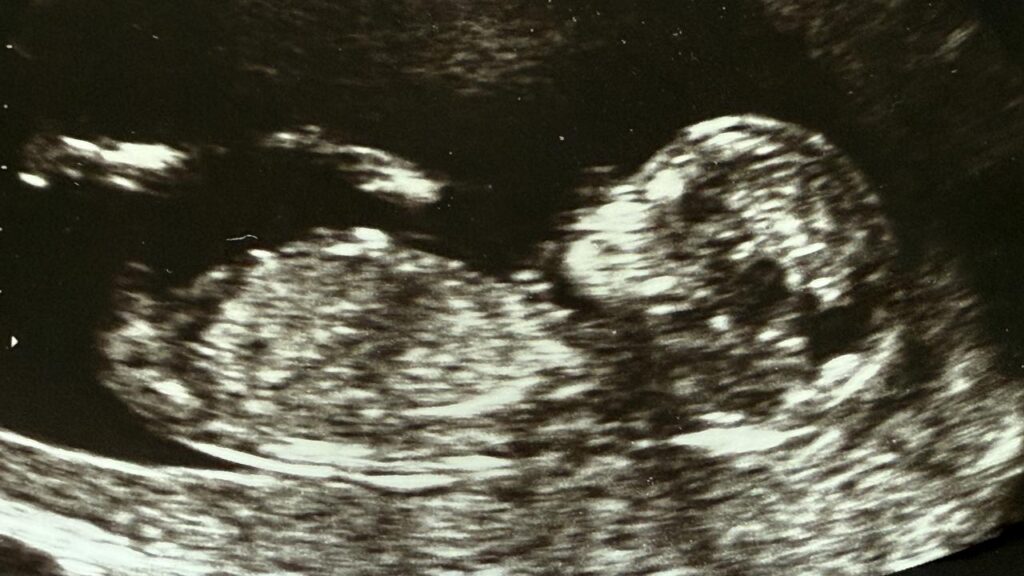 Monash IVF’s CEO has stepped down after the company was embroiled in a second embryo mix-up.
