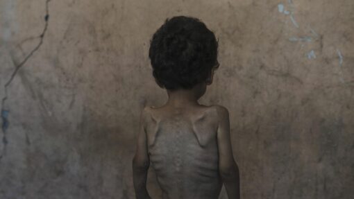 Mideast Wars Dying of Hunger