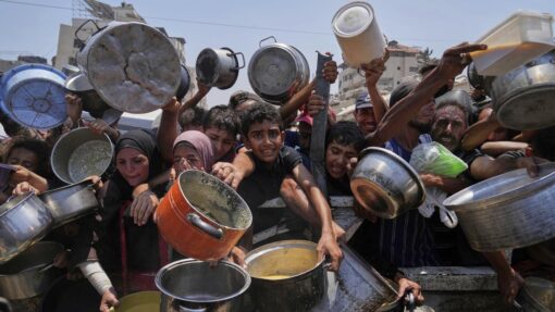 Mideast Wars Gaza Famine Photo Gallery