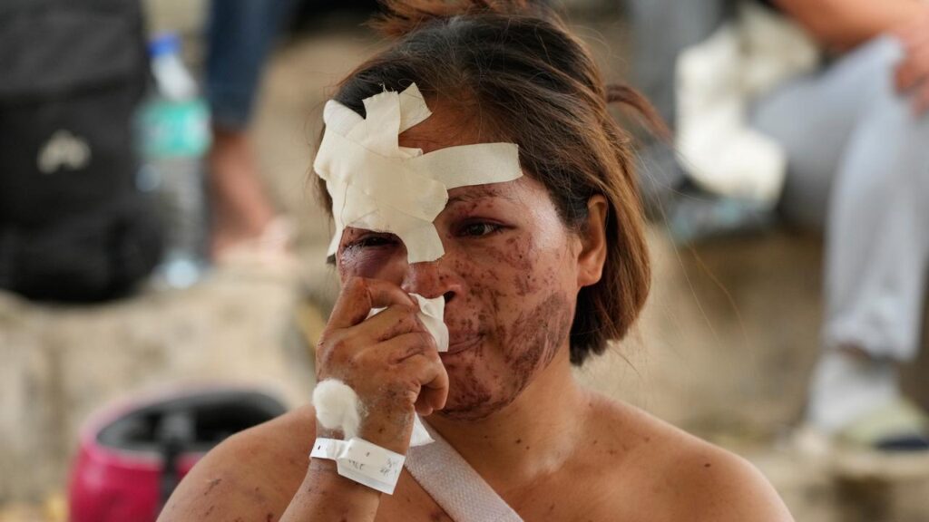 The quake has caused more than 20,000 people to be displaced, while more than 300 have been injured.
