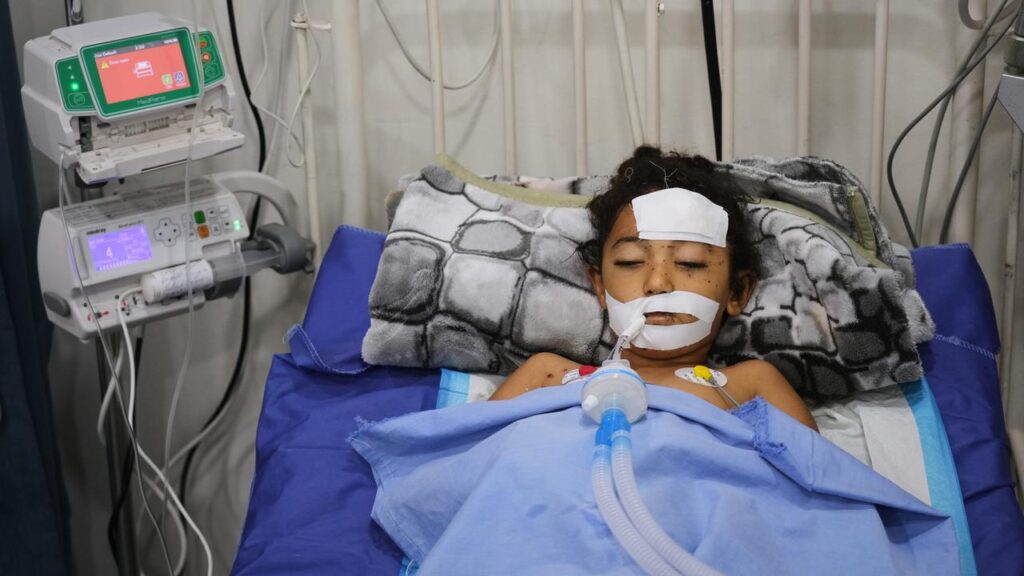 The twins have life-threatening injuries, including a lost hand and a hole in the bowel.