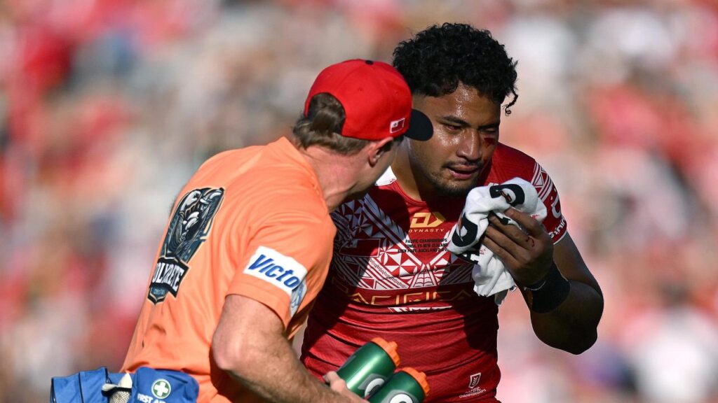 Tonga’s Eliesa Katoa receives on-field attention in the clash against New Zealand.

