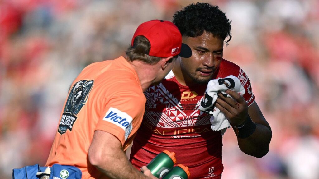 Tongan star Eliesa Katoa had to undergo surgery for brain bleeding. 
