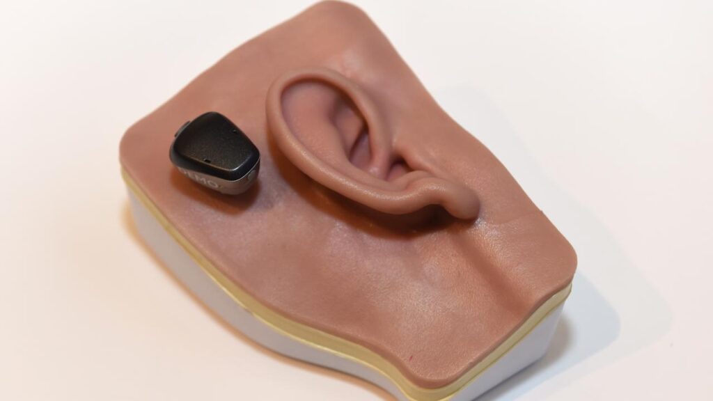 Hearing implant company Cochlear’s statutory net profit for the half-year fell 21 per cent.
