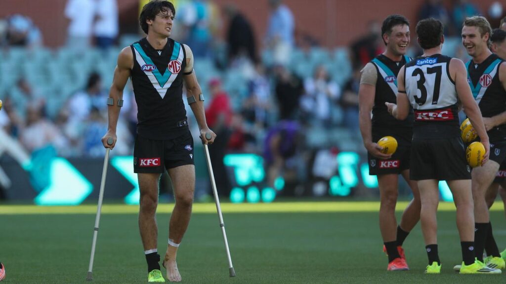Port’s Connor Rozee expects to be hamstrung for a big chunk of the AFL season.
