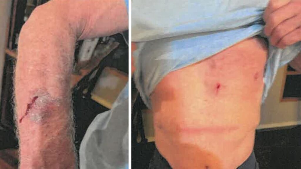 Mick Malthouse was left with arm and chest wounds after fighting off three alleged home invaders.
