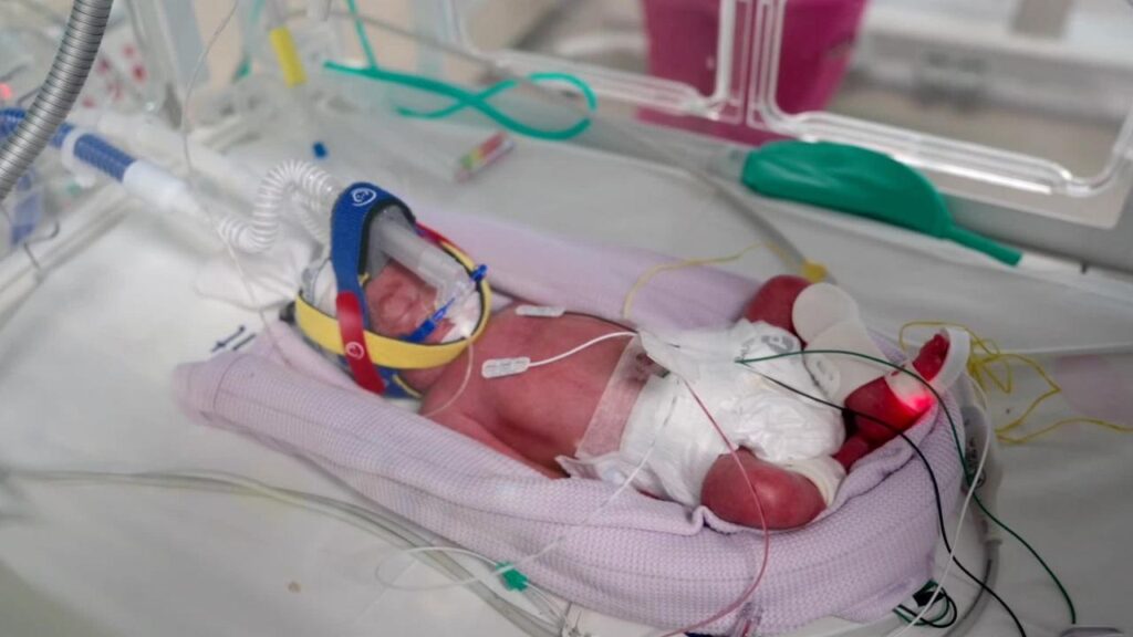 A Queensland mother has given birth to quadruplets – four identical girls.
