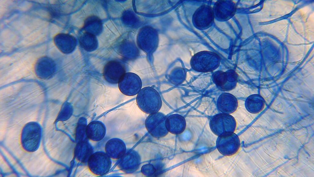 Understanding of how fungi can be targeted to boost food crops is still limited.
