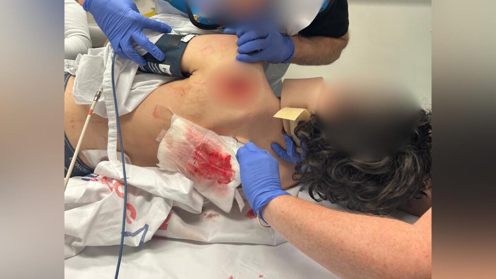 A teenager needed surgery after being slashed with a machete during a terrifying robbery.
