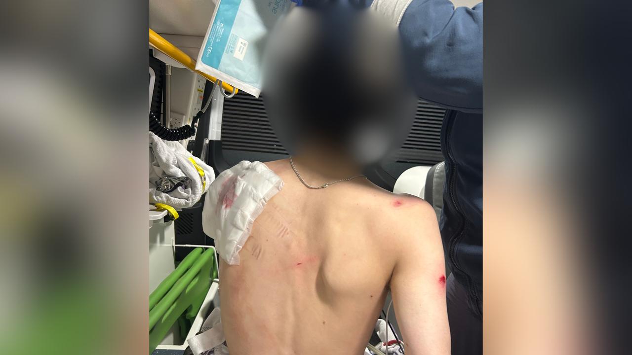 The teen's injuries after the attack