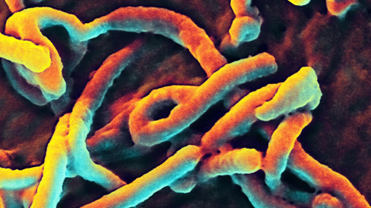 Micrograph of Ebola virus