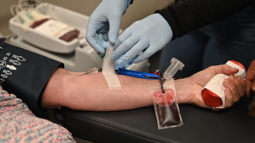Blood products giant CSL has recorded a big loss, but investors are pumping its shares higher.
