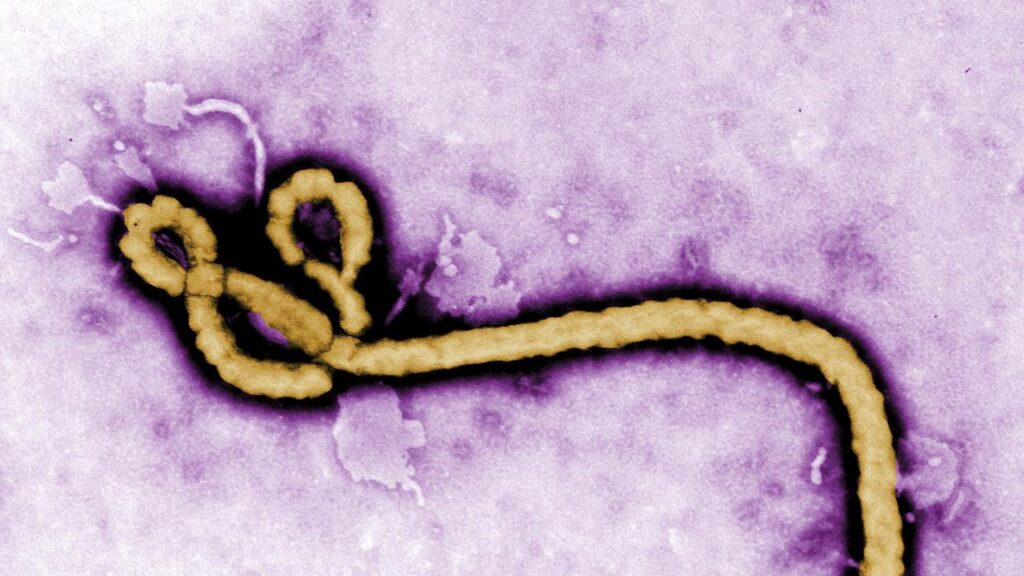 The Africa CDC organisation is planning studies to understand if the Ebola virus has mutated.
