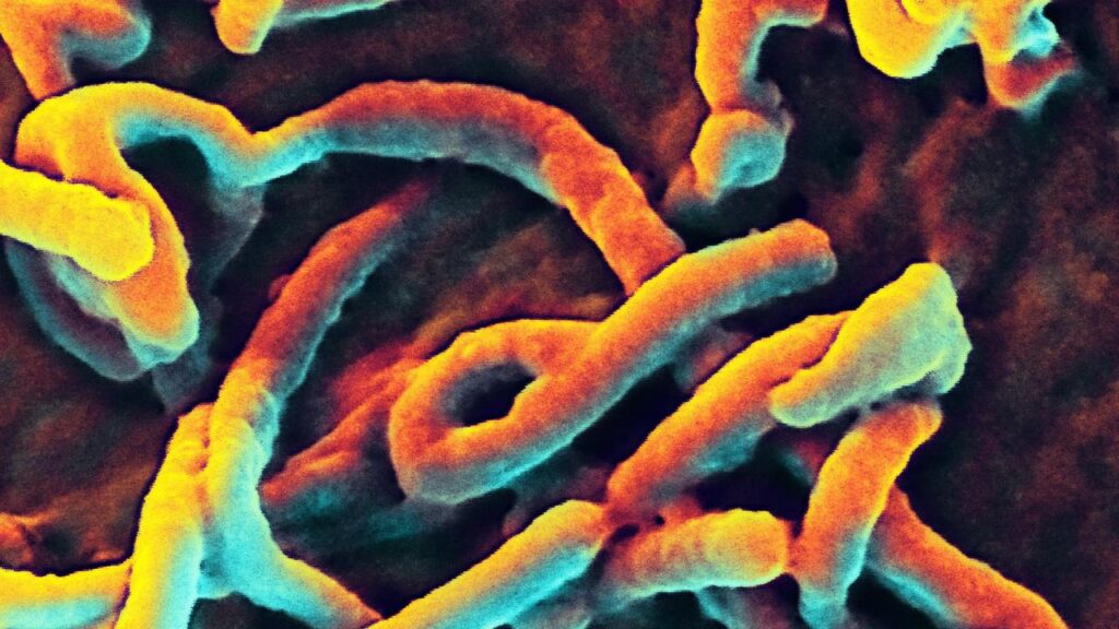 Scientists say a recent Ebola virus strain is ⁠distinct from previous Bundibugyo ​outbreaks.
