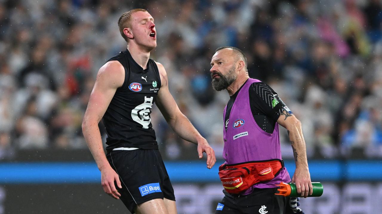 Harry Dean of Carlton