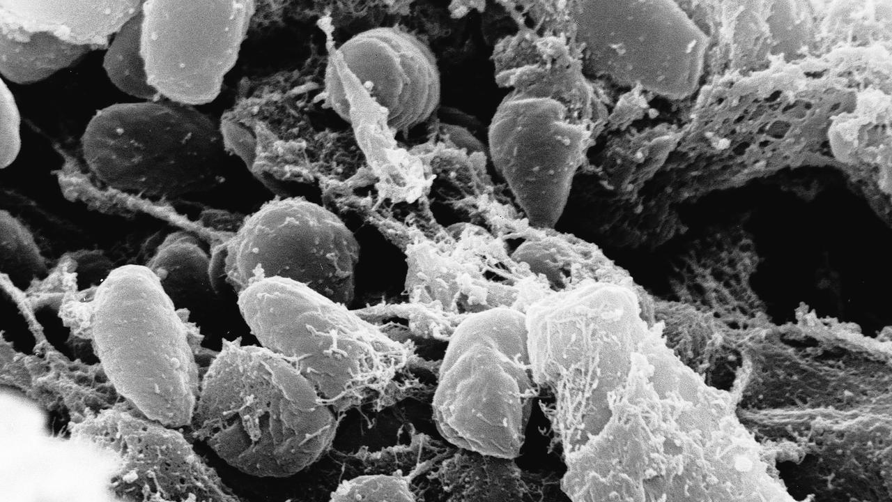 Yersinia pestis bacteria