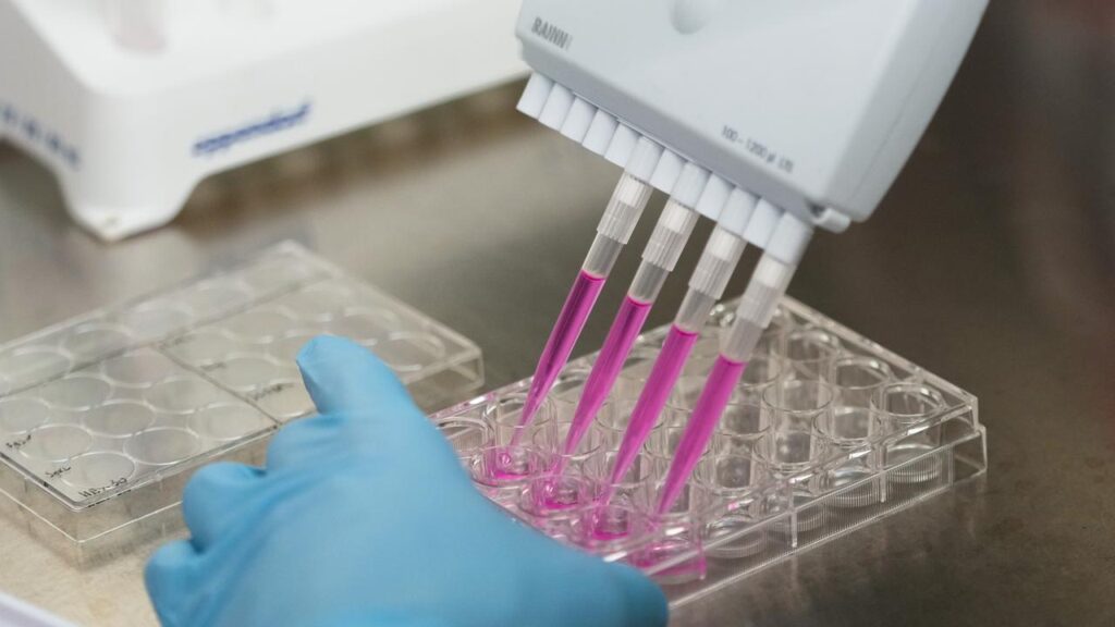 A cancer vaccine is helping significantly reduce the chances that melanoma patients’ tumours return.
